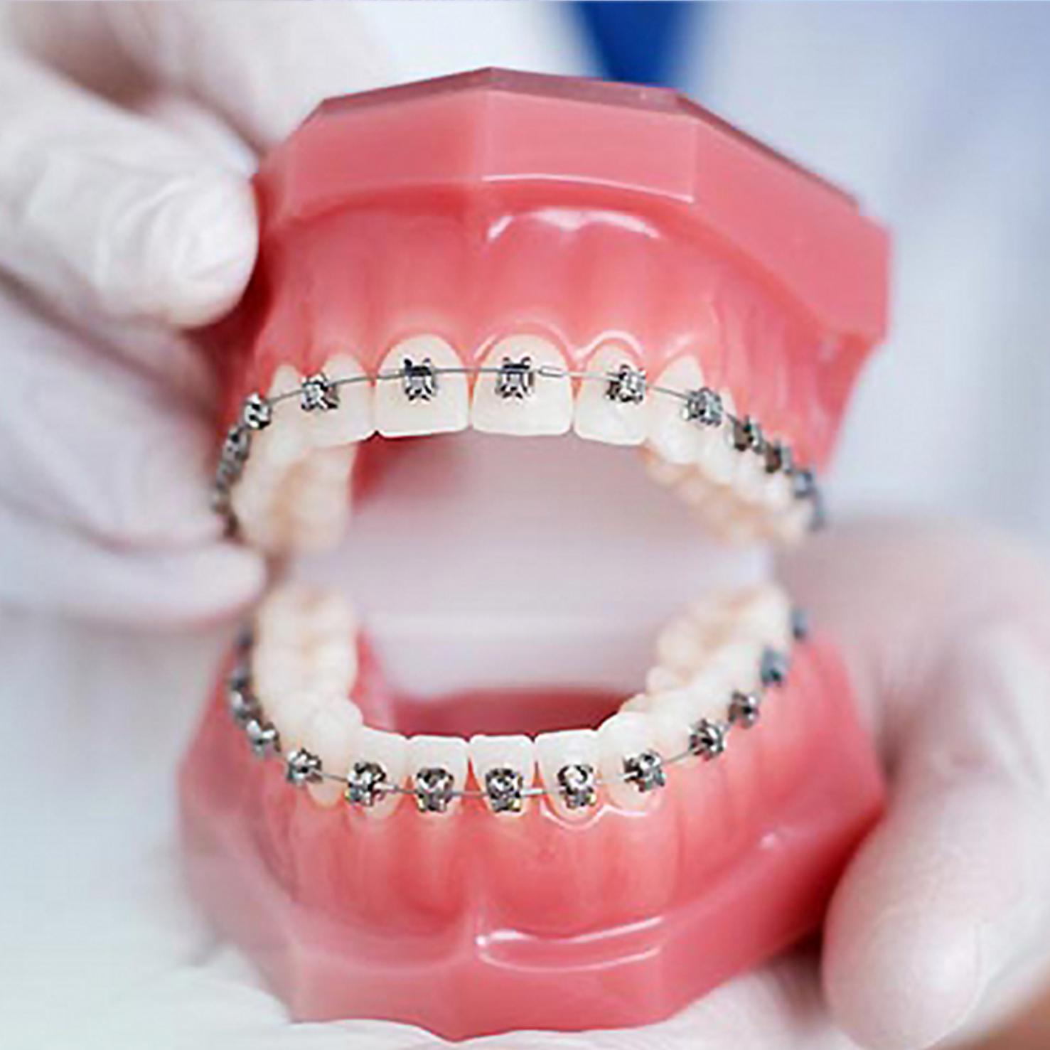 damon braces near me