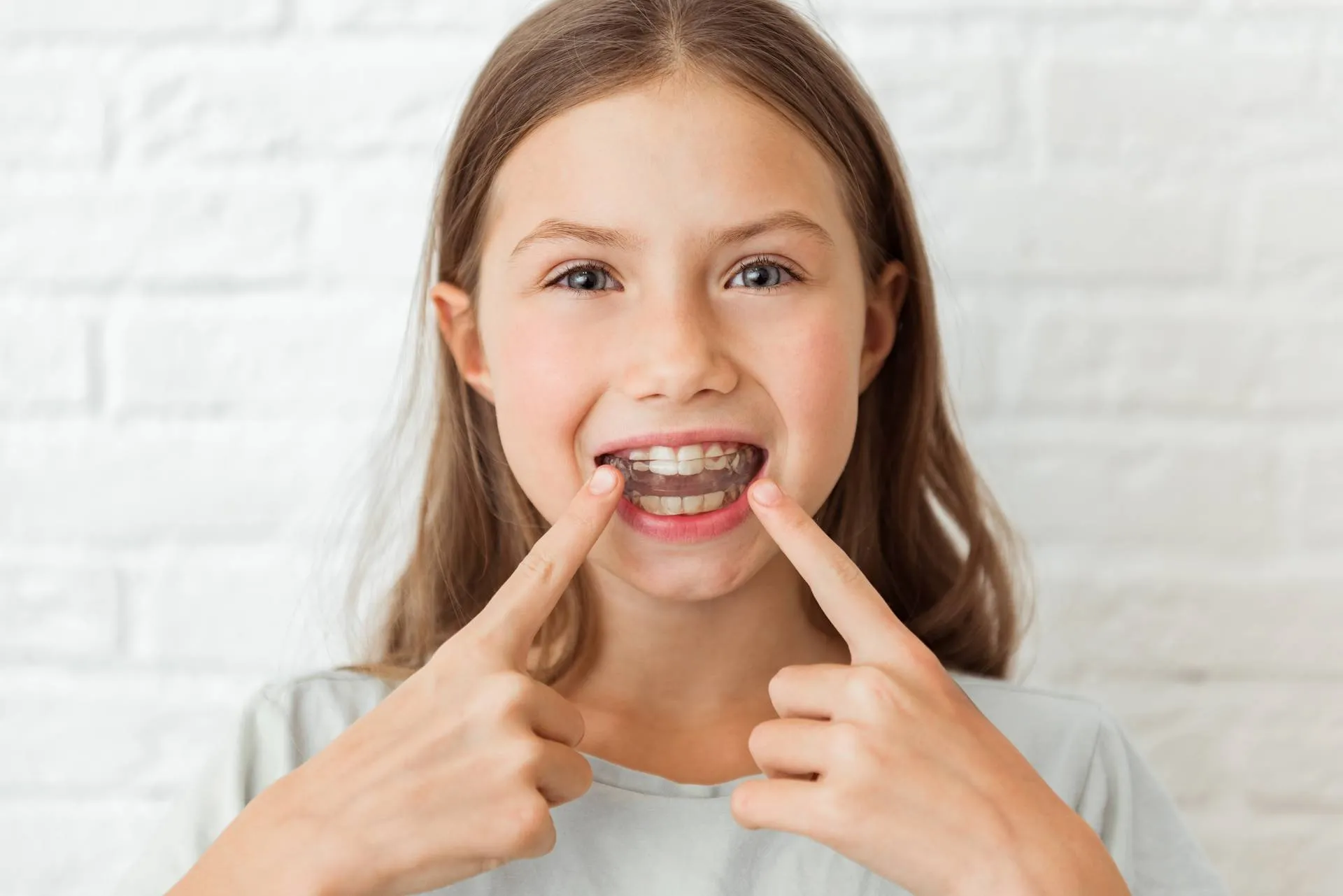 Why wear a Mouth Guard at night