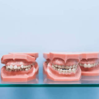 What Are Some Commonly Occurring Orthodontic Problems? Let’s Find Out. 1 Orthodontic Problems