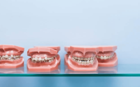 Orthodontic Problems