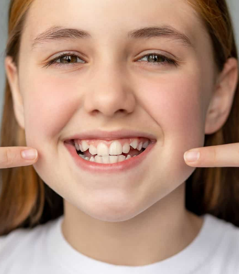 Teeth Braces Dubai