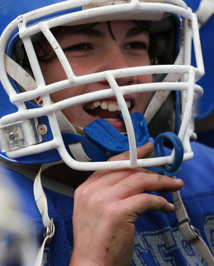 rugby mouthguards