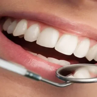Is Orthodontic Treatment Actually Expensive? 6 Is Orthodontic treatment expensive