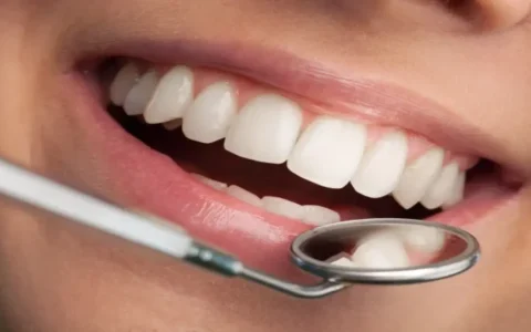 Is Orthodontic treatment expensive