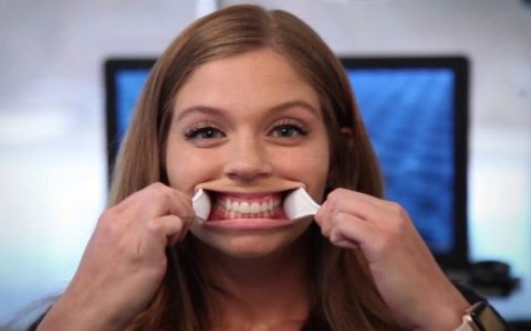 Online Braces Consultation