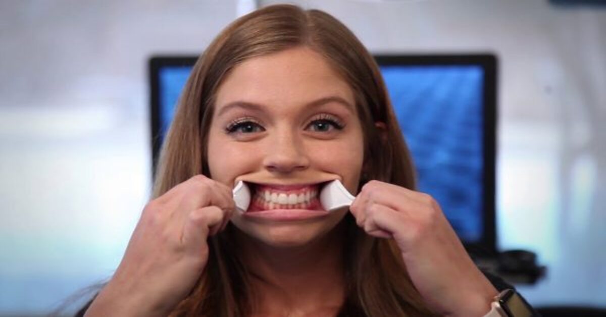 Online Braces Consultation